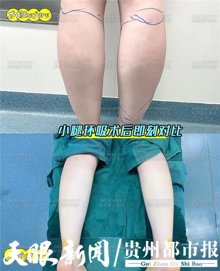 DƬ